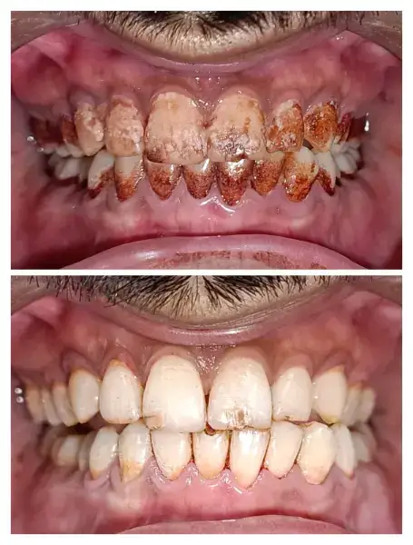 Samyak dental care and Implant Center Gallery Photo