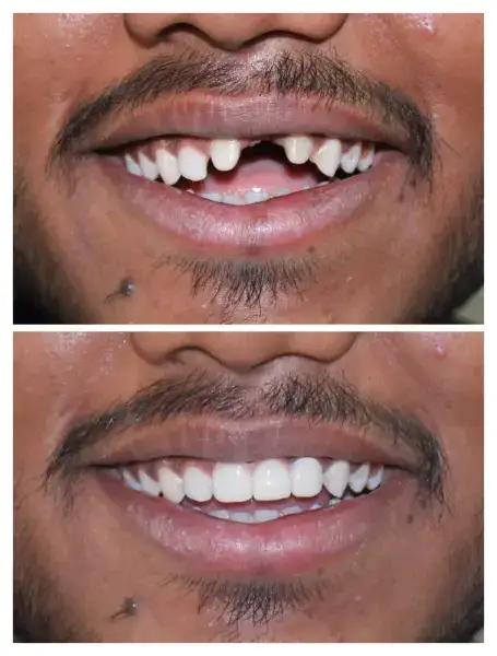 Samyak dental care and Implant Center Gallery Photo